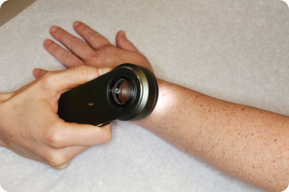 Digital dermoscopy examination of the skin